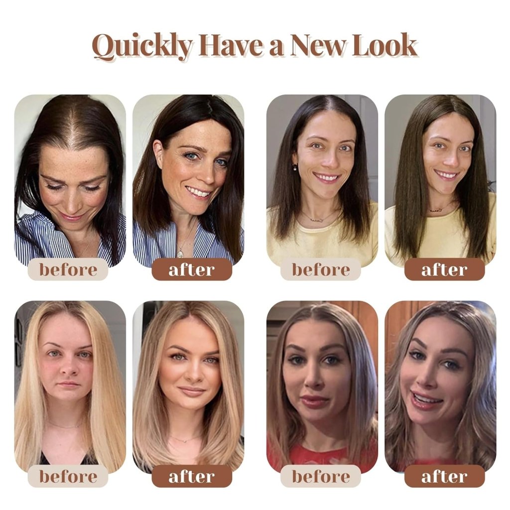 Hair Toppers for Women Real Human Hair 150% Density Clip In Topper Hairpieces 10 × 12CM Swiss Base Wiglet Top Hair Pieces for Women with Thinning Hair（12Inch,1B#）