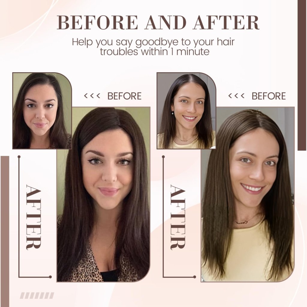 Hair Toppers for Women Real Human Hair 16 Inch for Thinning Hair