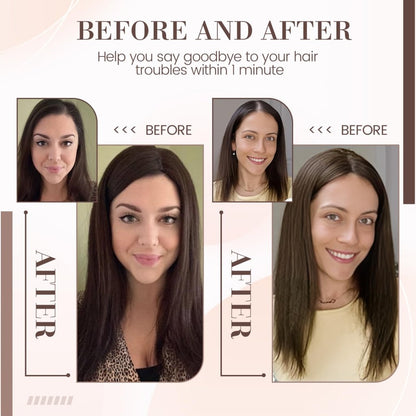 Hair Toppers for Women Real Human Hair 16 Inch for Thinning Hair