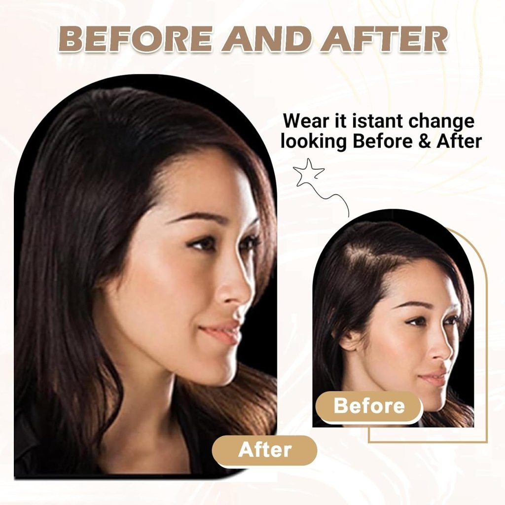 Human Hair Toppers for Women Real Human Hair Toppers Hair Pieces for Women 10 Inch Upgrade Swiss Base Hair Toppers for Women with Thinning Hair-Natural Black